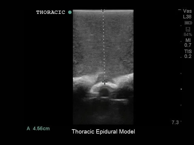 Lumbar Puncture and Spinal Epidural Training Model